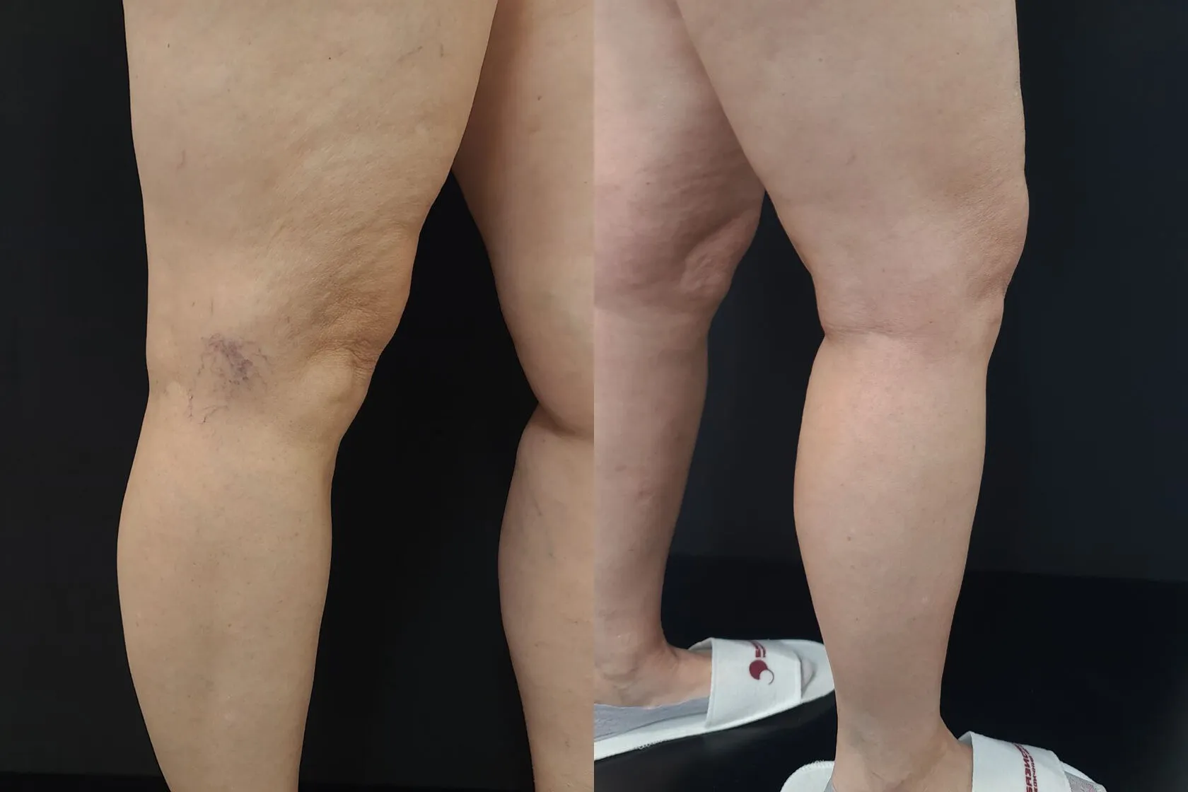 Clinical case image