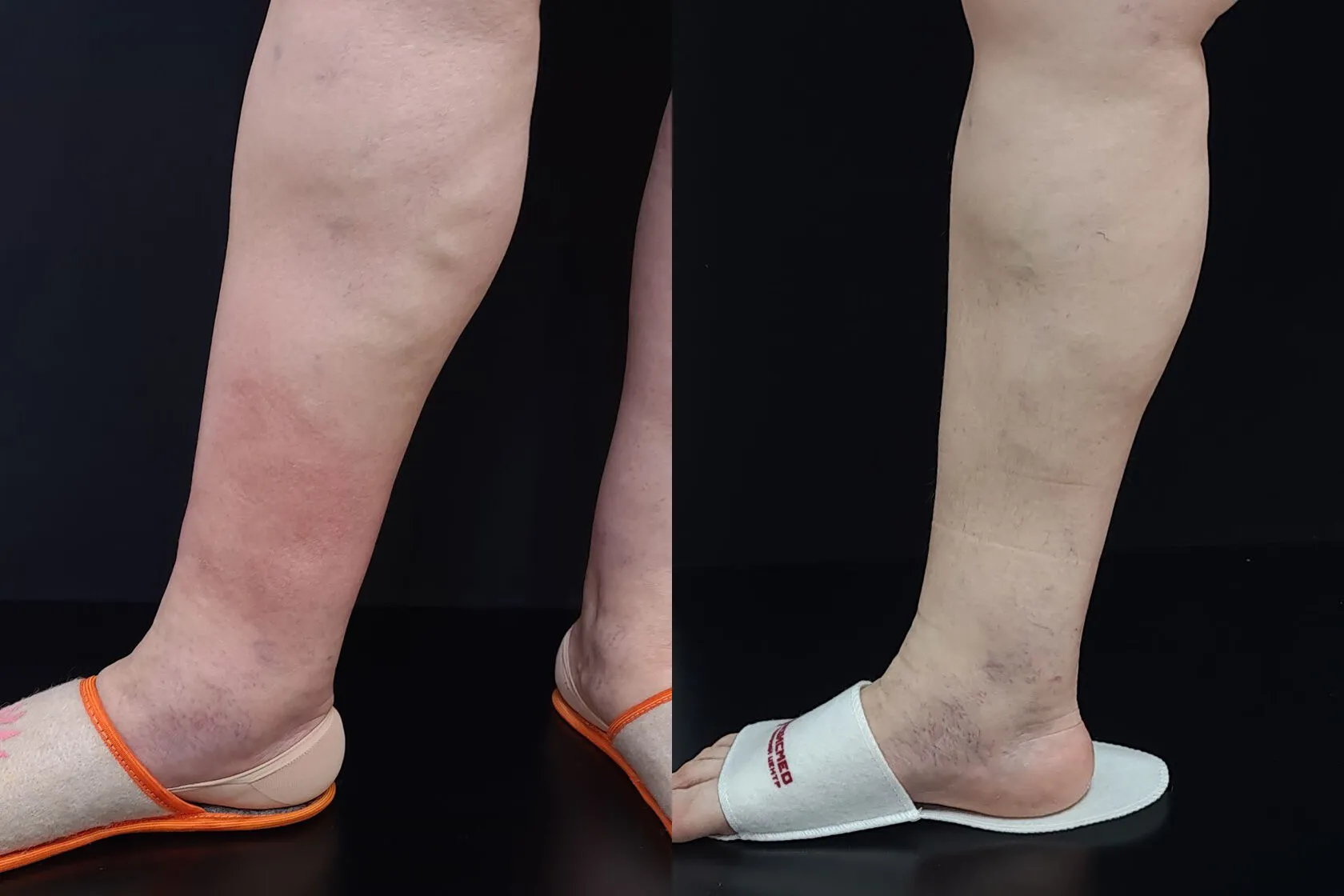 Clinical case image