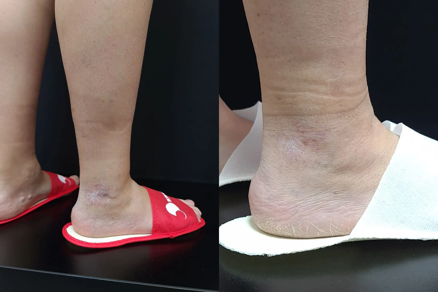 Clinical case image