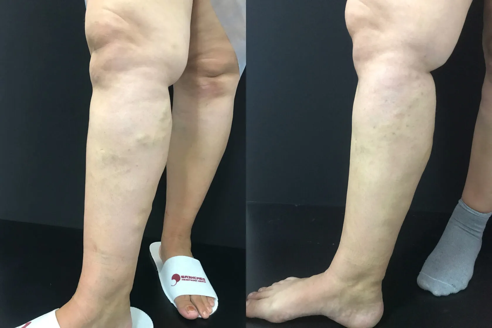 Clinical case image