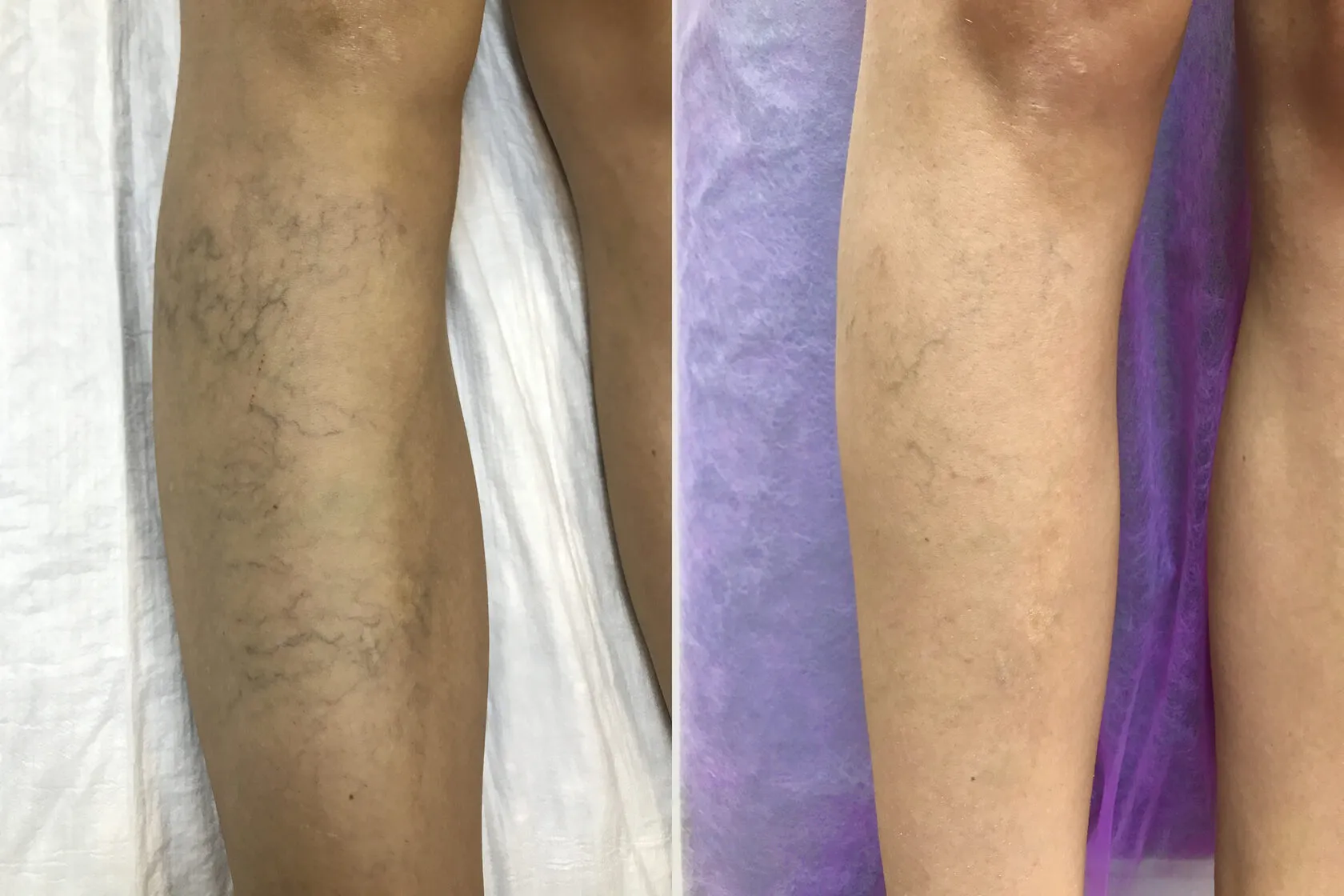 Clinical case image