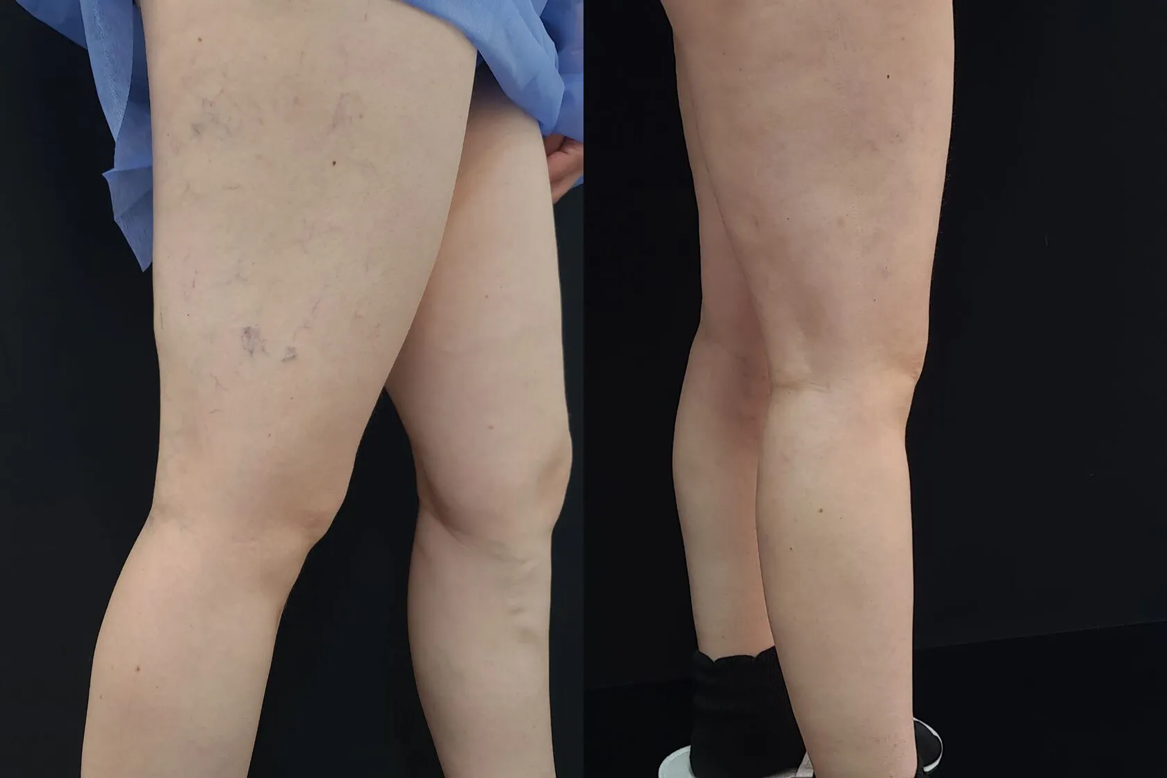 Clinical case image
