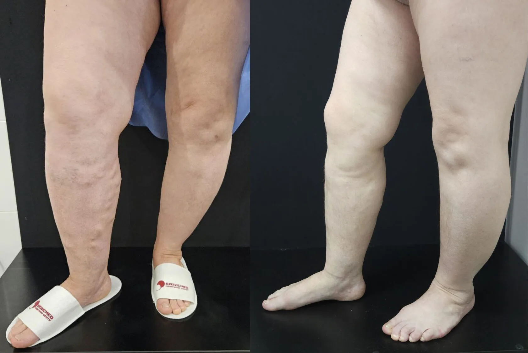 Clinical case image