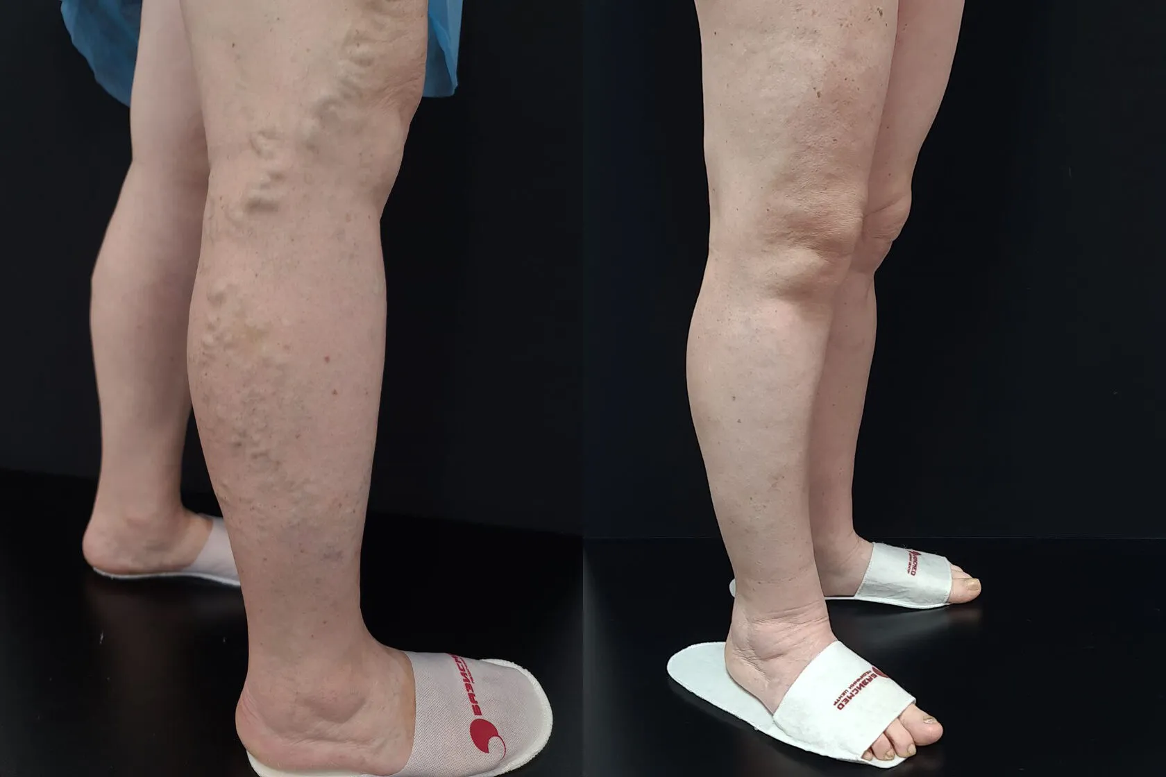 Clinical case image