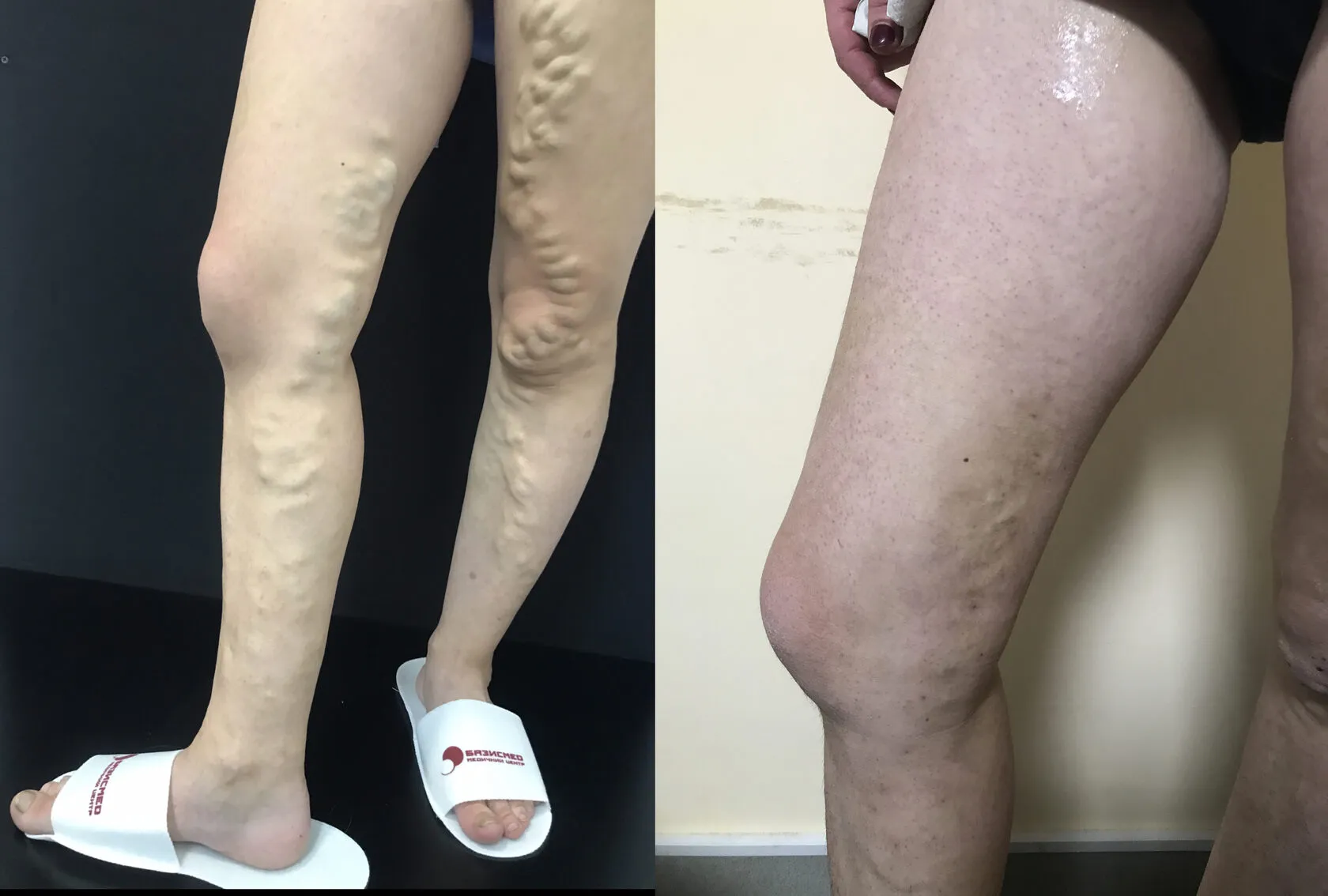 Clinical case image