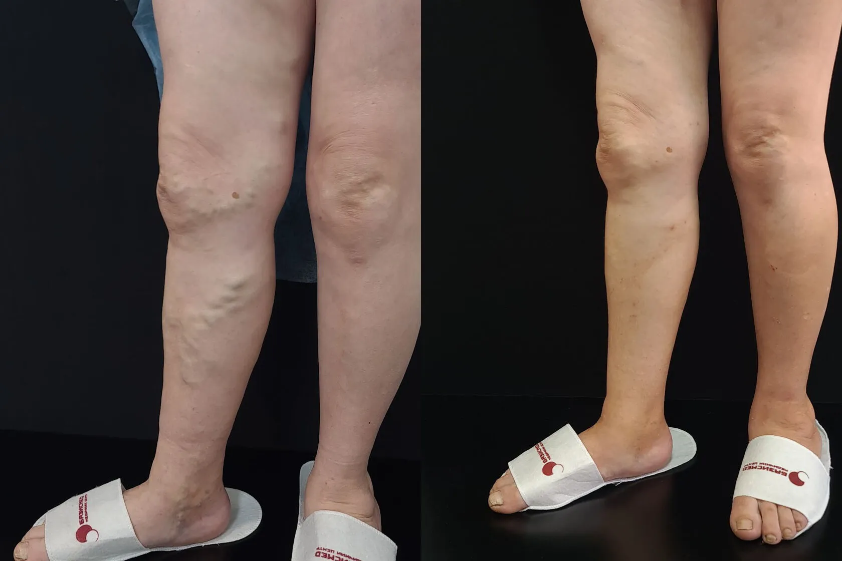 Clinical case image