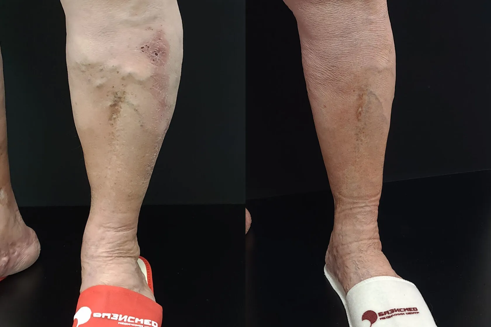 Clinical case image